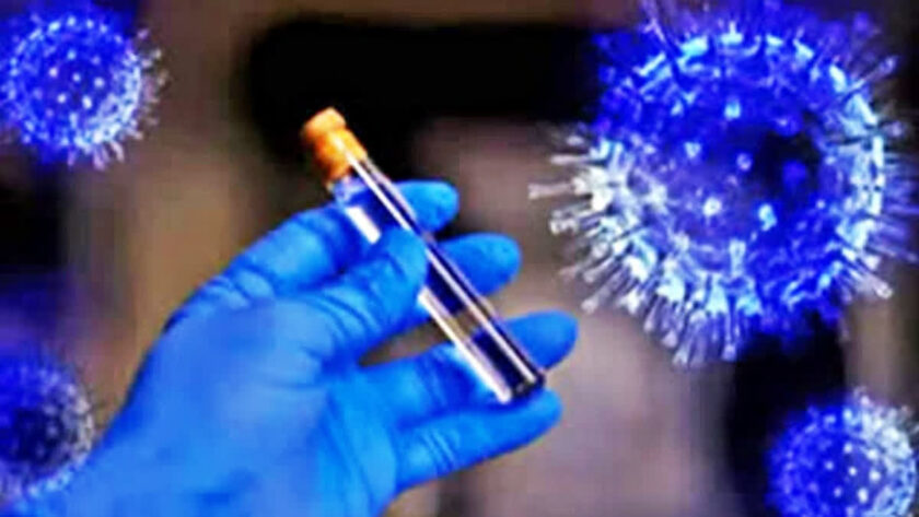 Ebola Airport Surveillance, Ebola International Airport, Ebola Alert in India, Ebola Surveillance Continues, Ebola Virus Disease,